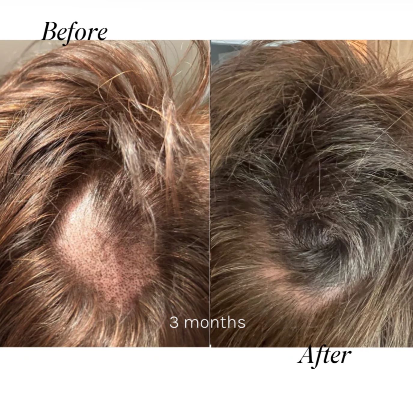 Tender Love and Hair - Menopause Hair Loss Vitamins