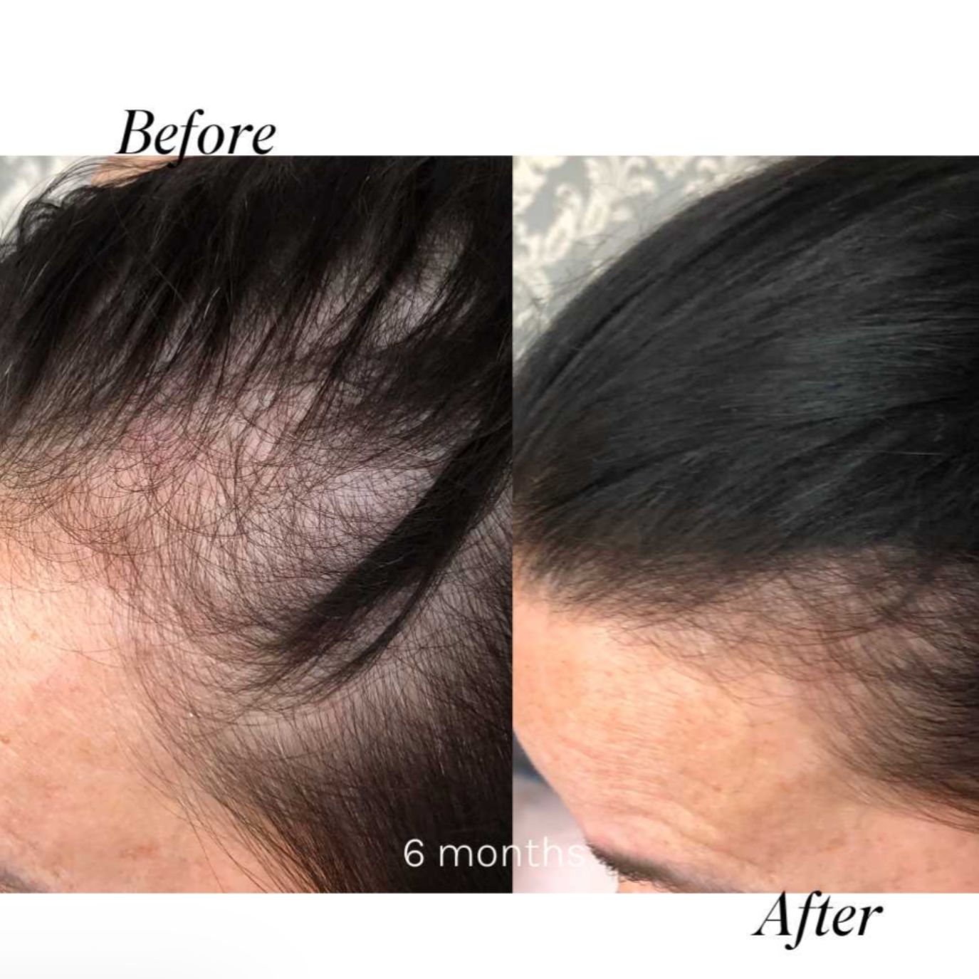 Tender Love and Hair - Menopause Hair Loss Vitamins